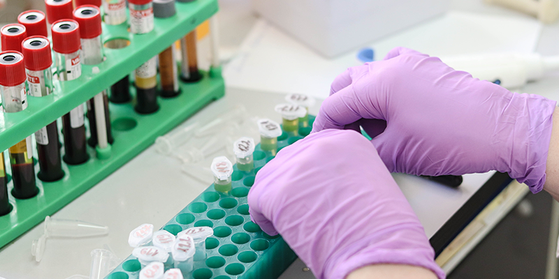 十年長青！博大博聚JSY型全自動細胞計數儀：憑什么成科研人心中的細胞計數 “經典款”？